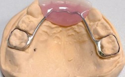 正畸关闭间隙材料