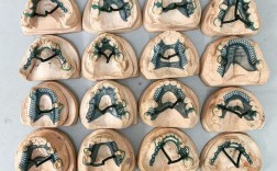 牙科支架制作方法的具体步骤和技术要点是什么？