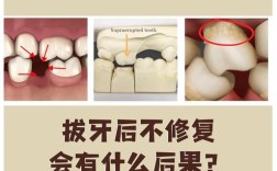 拔牙不种牙可行吗？会有什么影响吗？