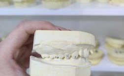 正畸后石膏模型到底有什么用？对牙齿维护和美观有何帮助？