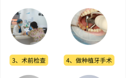 种牙全过程痛吗