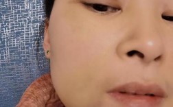 种牙后牙肿了？原因分析与科学应对方法详解