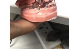 口外正畸牵引装置腔内应用有哪些注意事项？