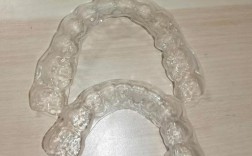 定制的正畸保持器