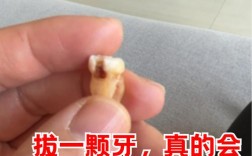 矫正牙齿拔了一颗牙
