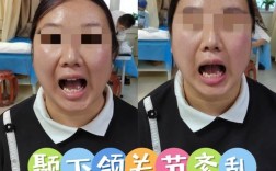 正畸治疗与颞颌关节紊乱，存在怎样的关联？