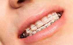 孕妇矫正牙齿松动