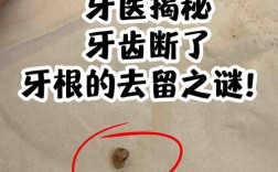 牙根断了必须种牙吗？还有其他修复选择吗？
