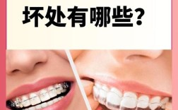 矫正牙齿必须戴牙套吗？还有其他矫正方式吗？