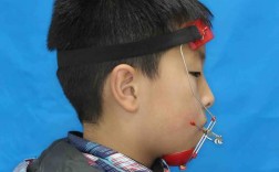 牙齿矫正器哪种效果更好？矫正效果如何选？