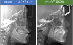 正畸头颅片怎么拍？拍摄步骤、要点与注意事项有哪些？
