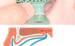 全口牙取模有哪些常用方法？不同方法在操作步骤和适用人群上有何区别？如何确保取模过程的准确性与舒适度？