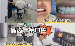 氧化牙最好的治疗方法究竟是什么？