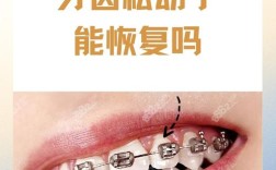 矫正牙牙齿会松动么