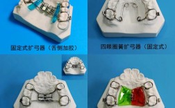 牙齿矫正扩弓器如何正确使用？操作步骤、方法及注意事项有哪些？