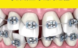 牙齿矫正过程视频，真实过程到底如何呢？