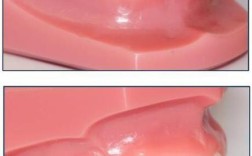 德国进口牙齿矫正器效果好吗？安全有保障吗？适合哪些人？