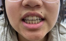 北大口腔正畸后失败