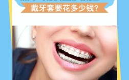 牙齿矫正一般需多少钱？价格受哪些因素影响？