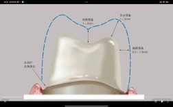 全瓷冠制作的具体步骤和技术要点是什么？