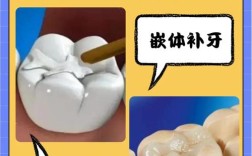 牙体缺损粘结修复有哪些常用方法？