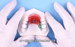 儿童牙齿功能性矫正器效果如何？适合哪些情况？