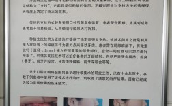 北大校医院矫正牙齿