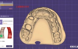 氧化锆牙齿成型有哪些关键技术方法？