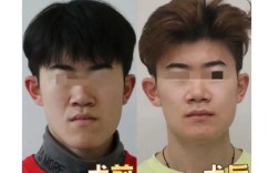 王雪东正畸案例