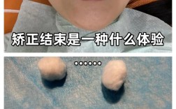 虎门矫正牙齿哪里好？靠谱机构怎么选？