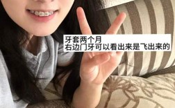 22岁矫正牙齿晚不晚？现在开始还来得及吗？