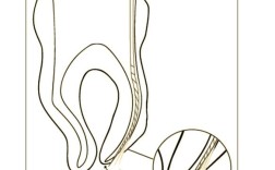 根管预备方法的选择、步骤及操作要点有哪些？