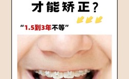 青少年矫正牙齿一般需要多长时间？