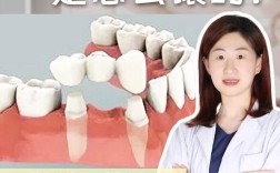 热凝镶牙方法