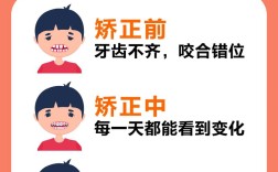 牙齿矫正哪里便宜？想做但预算有限，求实惠推荐！