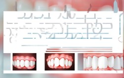 牙齿天包地到底要不要矫正？