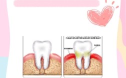 烂牙缝怎么处理？实用方法有哪些？