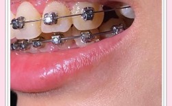 九院正颌真的不管正畸吗？正颌前必须先做正畸吗？两者治疗该如何衔接？