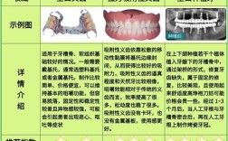 牙齿缺损后，哪种修复方法效果最好？