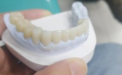 种牙哪种材质好
