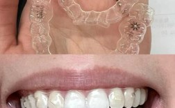 上海牙齿矫正哪里最好？求靠谱医院与医生推荐！