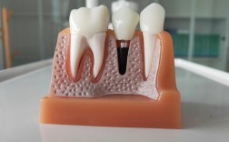 位置窄种植牙种细植体