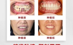 全国种植牙案例库，海量真实案例如何帮患者预见种植效果与风险？