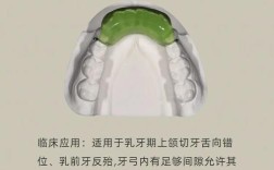 矫正牙齿的斜导是什么