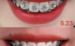 浙二口腔正畸在哪