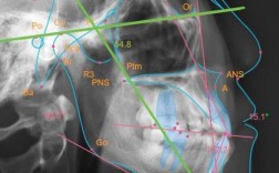美国正畸头影测量如何精准辅助正畸诊疗？