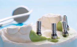 苏州牙博士种牙效果好吗？真实口碑与价格如何？