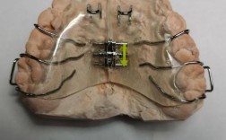 正畸弹簧扩弓器有何作用？使用方法与注意事项有哪些？