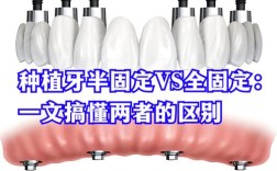 种牙还是隐形义齿，选哪个更适合你？