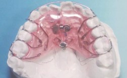 正畸帽和矫正器